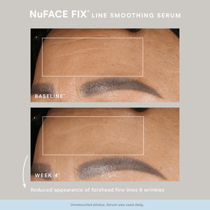 NuFACE FIX® Starter Kit | NuFACE