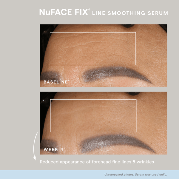 NuFACE FIX® Serum | NuFACE