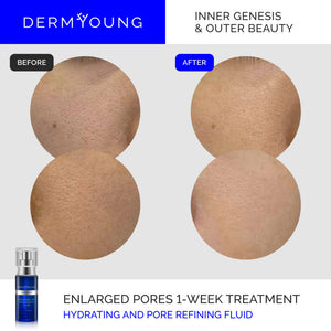 I-Genesis Hydrating and Pore Refining Fluid | DermYoung